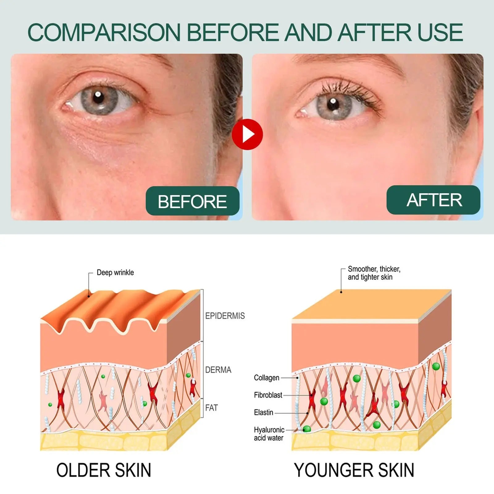 OUHOE Essence collagen replenishing essence whitening freckle removal facial essence brightening hydrating moisturizing eprolo   SMARTGLO COLLECTIONS