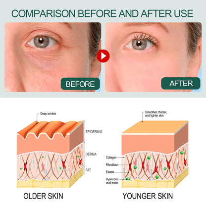 OUHOE Essence collagen replenishing essence whitening freckle removal facial essence brightening hydrating moisturizing eprolo   SMARTGLO COLLECTIONS